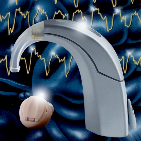 助聽器發展歷程8.jpg