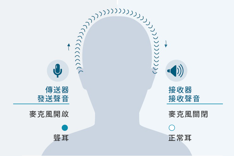 重拾全方位聆聽－峰力CROS單側聽障用家分享1.jpg